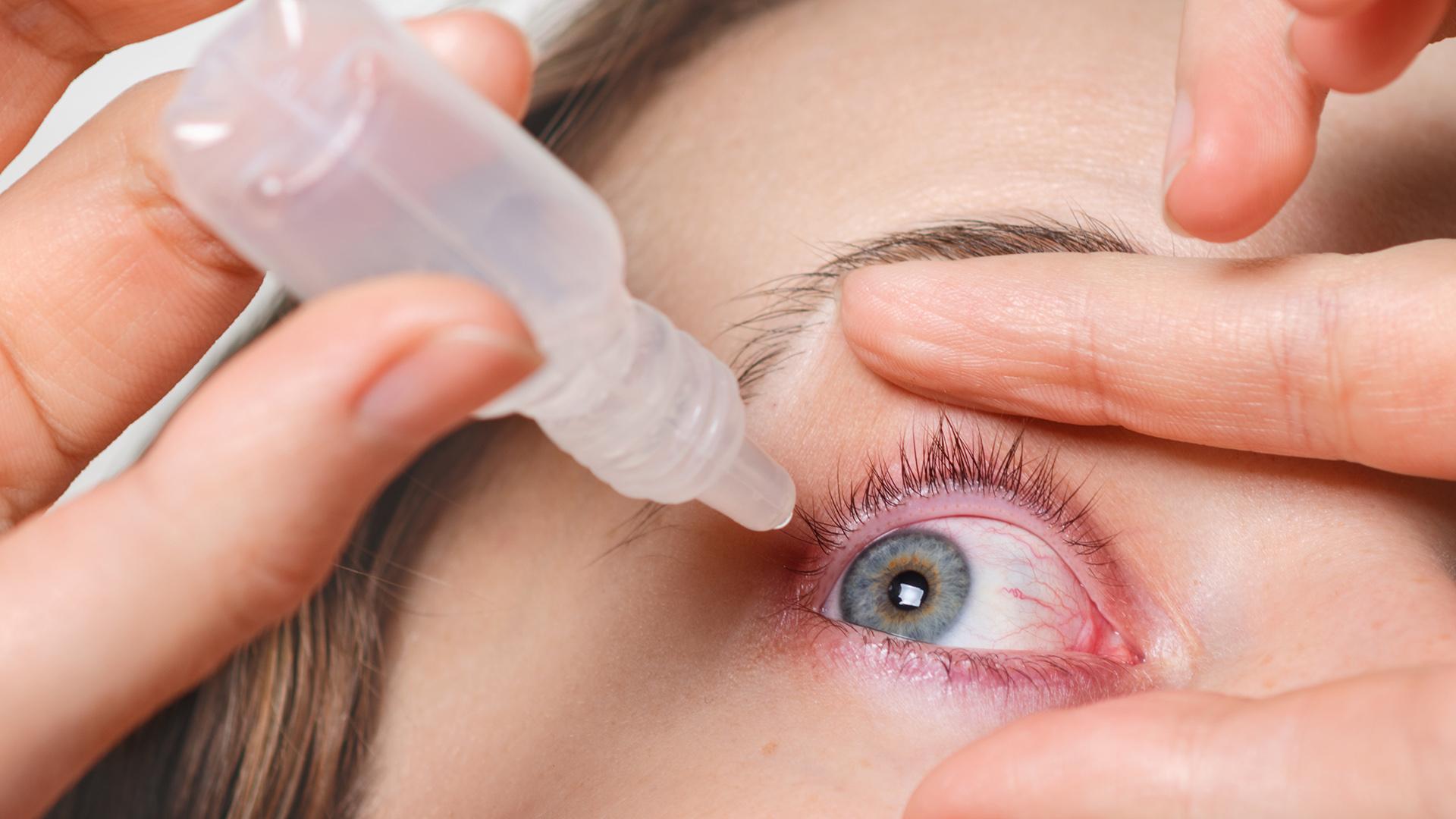 صحة العين : كيفية علاج جفاف العين بشكل طبيعي